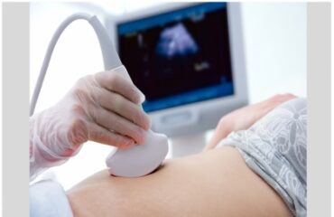 Imagem-noticia-ecocardiograma-site
